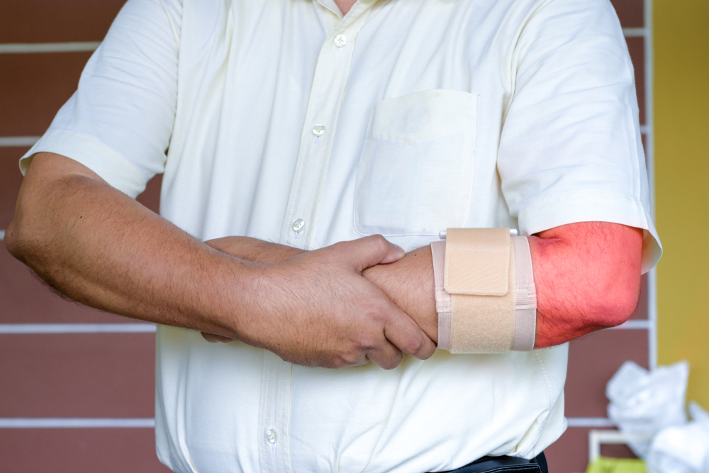 Is Tennis Elbow Lifelong