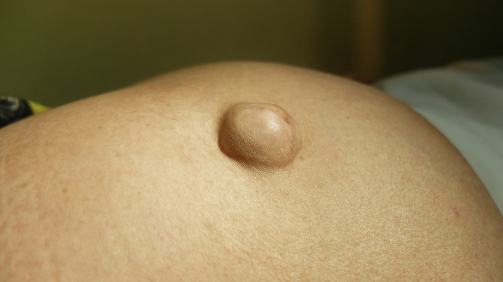 Can You Get A Hernia From Brazilian Jiu-Jitsu?