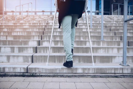 Can I Climb Stairs After ACL Surgery?