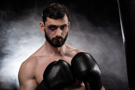 How Long Do Boxing Bruises Last?